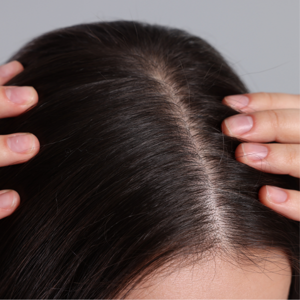 SMOOTH SCALP